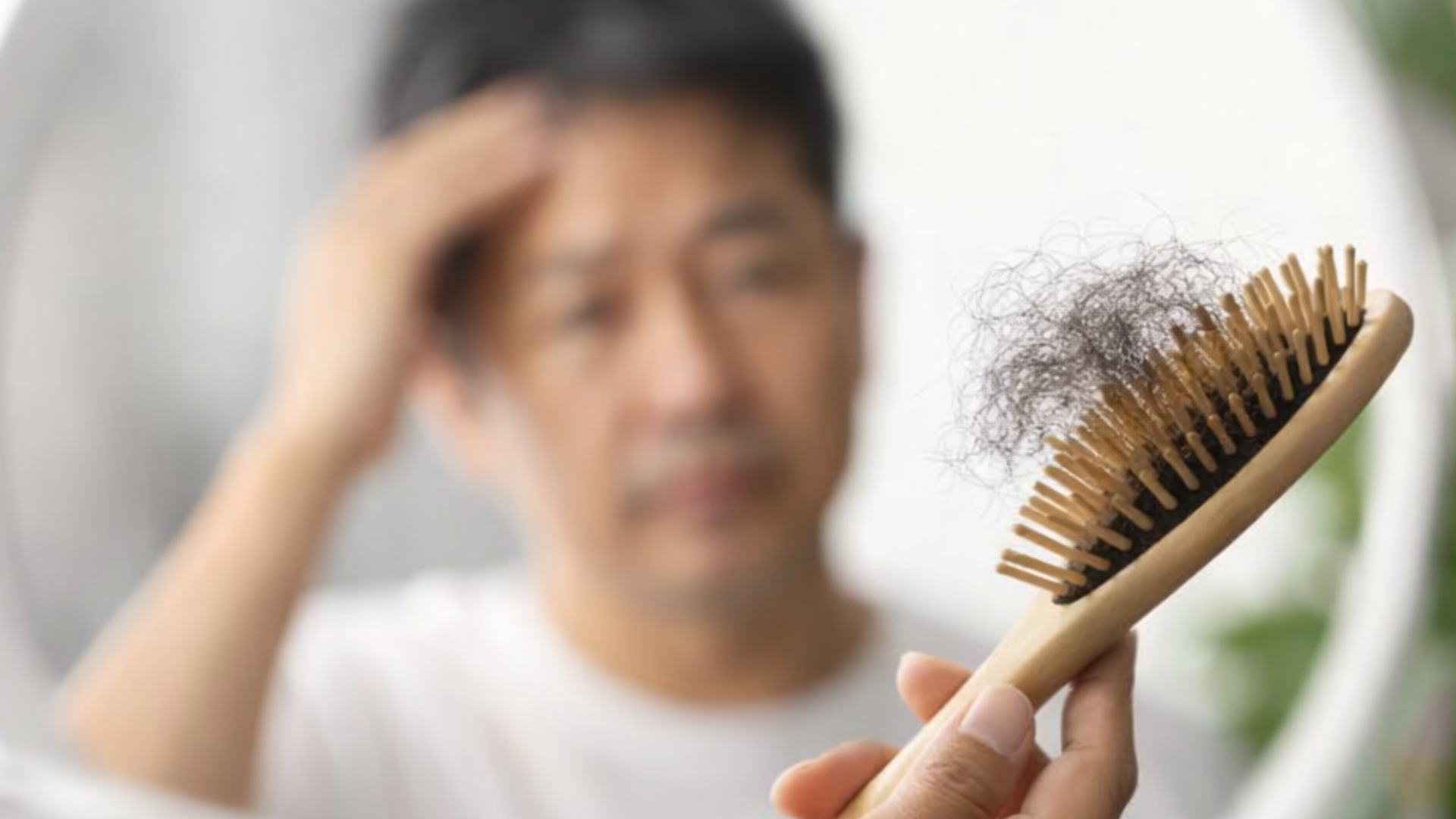 hair loss men