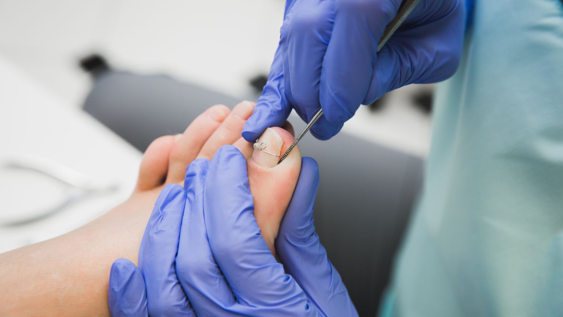 GP doctor is removing ingrown nail